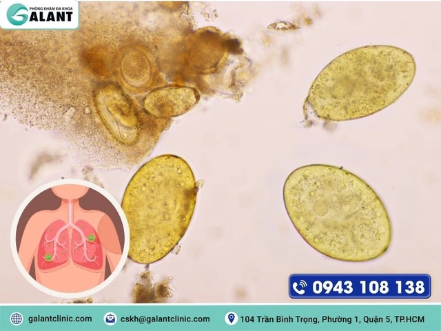 Xem Hình Ảnh Trứng Sán Lá Phổi: Đặc Điểm Nhận Dạng Và Ý Nghĩa Chẩn Đoán Xem Hình Ảnh Trứng Sán Lá Phổi: Đặc Điểm Nhận Dạng Và Ý Nghĩa Chẩn Đoán