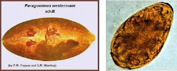Xem Hình Ảnh Trứng Sán Lá Phổi: Đặc Điểm Nhận Dạng Và Ý Nghĩa Chẩn Đoán Xem Hình Ảnh Trứng Sán Lá Phổi: Đặc Điểm Nhận Dạng Và Ý Nghĩa Chẩn Đoán