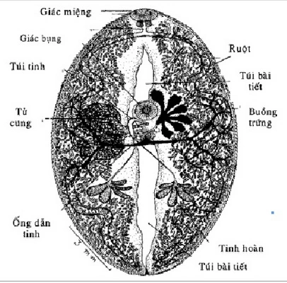 Xem Hình Ảnh Trứng Sán Lá Phổi: Đặc Điểm Nhận Dạng Và Ý Nghĩa Chẩn Đoán Xem Hình Ảnh Trứng Sán Lá Phổi: Đặc Điểm Nhận Dạng Và Ý Nghĩa Chẩn Đoán