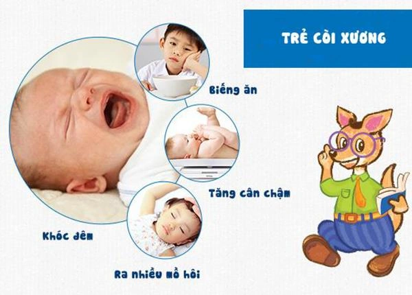 Hình Ảnh Bệnh Còi Xương: Nhận Biết Dấu Hiệu, Nguyên Nhân Và Cách Phòng Ngừa Cho Trẻ