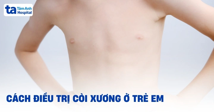 Hình Ảnh Bệnh Còi Xương: Nhận Biết Dấu Hiệu, Nguyên Nhân Và Cách Phòng Ngừa Cho Trẻ