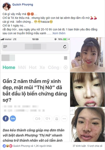 100+ Hình Ảnh Về Thị Nở Đẹp 2026 – Bạn Đã Xem Chưa? 100+ Hình Ảnh Về Thị Nở Đẹp 2026 – Bạn Đã Xem Chưa?