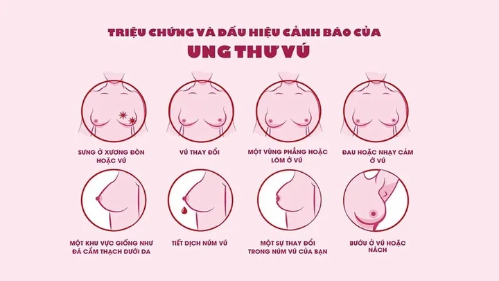 Hiểu Rõ Hình Ảnh Vú Phụ Nữ: Các Loại Hình Dạng, Kích Cỡ, Núm Vú Và Dấu Hiệu Bất Thường