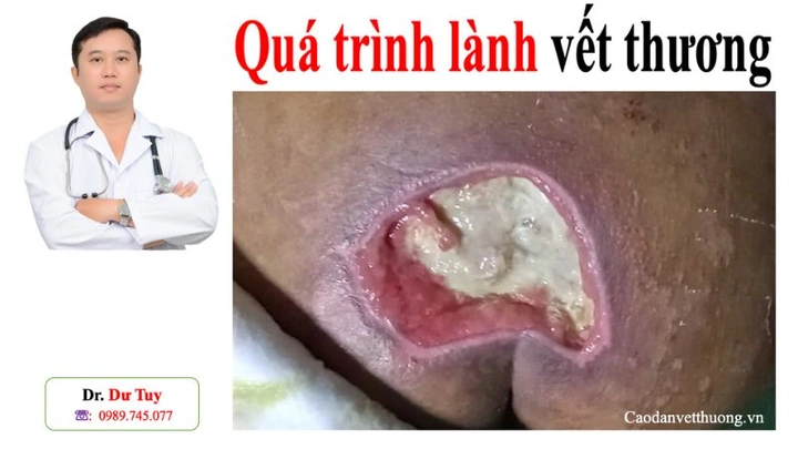 Tổng Hợp Hình Ảnh Vết Thương Tai Nạn Té Xe Thật: Từ Trầy Xước Nhẹ Đến Chấn Thương Nặng Cho Nam Nữ