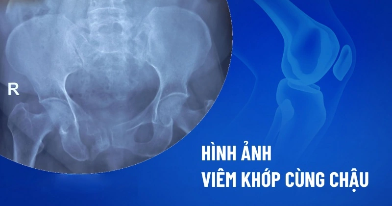 100+ Hình Ảnh Xương Chậu 4k Đẹp Nhất 2026 – Bạn Đã Sẵn Sàng Tải Ngay? 100+ Hình Ảnh Xương Chậu 4k Đẹp Nhất 2026 – Bạn Đã Sẵn Sàng Tải Ngay?
