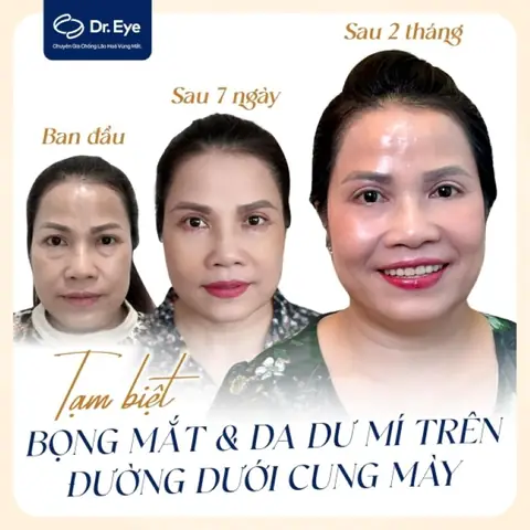 Làm Chân Mày Có Ảnh Hưởng Đến Tướng Số Không