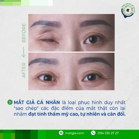 Mất Bao Nhiêu Tiền Thì Được Trình Báo Công An Và Bị Truy Cứu Trách Nhiệm Hình Sự? Mất Bao Nhiêu Tiền Thì Được Trình Báo Công An Và Bị Truy Cứu Trách Nhiệm Hình Sự?