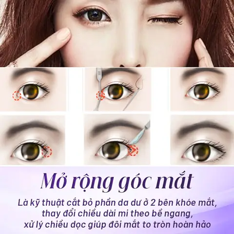 Mất Bao Nhiêu Tiền Thì Được Trình Báo Công An Và Bị Truy Cứu Trách Nhiệm Hình Sự? Mất Bao Nhiêu Tiền Thì Được Trình Báo Công An Và Bị Truy Cứu Trách Nhiệm Hình Sự?
