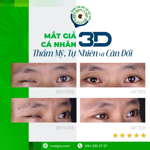 Mất Bao Nhiêu Tiền Thì Được Trình Báo Công An Và Bị Truy Cứu Trách Nhiệm Hình Sự? Mất Bao Nhiêu Tiền Thì Được Trình Báo Công An Và Bị Truy Cứu Trách Nhiệm Hình Sự?