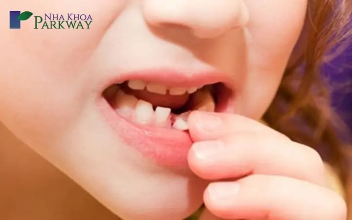 Mơ Bị Gãy Răng Cửa Là Điềm Báo Gì