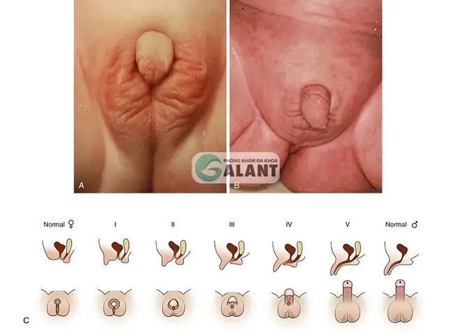 Giải Mã Giấc Mơ Thấy Bộ Phận Sinh Dục Của Mình: Ý Nghĩa, Điềm Báo Và Con Số May Mắn Giải Mã Giấc Mơ Thấy Bộ Phận Sinh Dục Của Mình: Ý Nghĩa, Điềm Báo Và Con Số May Mắn