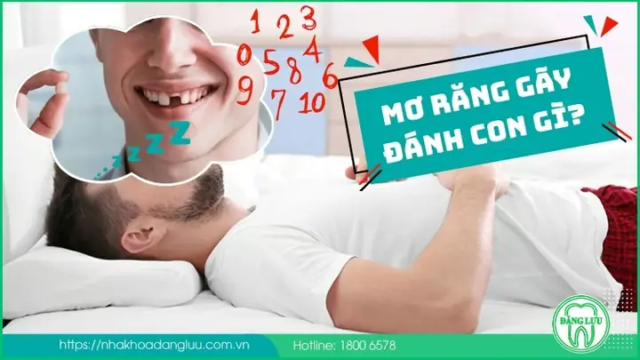 Mơ Thấy Đi Làm Răng Đánh Con Gì Mơ Thấy Đi Làm Răng Đánh Con Gì