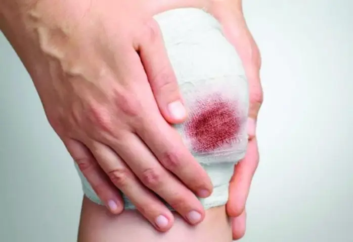 Mơ Thấy Máu Chảy: Ý Nghĩa, Điểm Báo Lành Xấu Và Cách Giải Mã