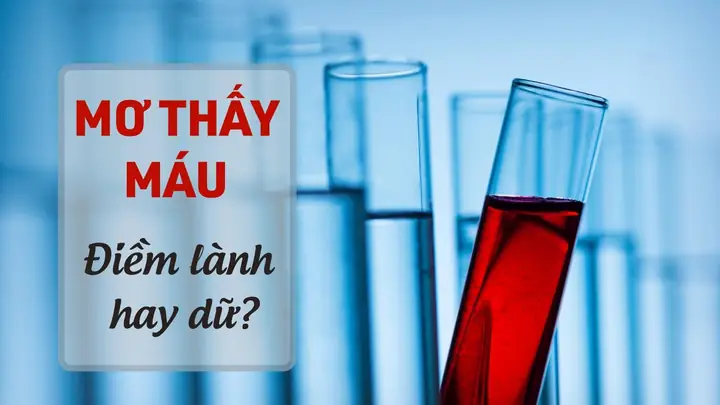 Mơ Thấy Máu Chảy: Ý Nghĩa, Điểm Báo Lành Xấu Và Cách Giải Mã