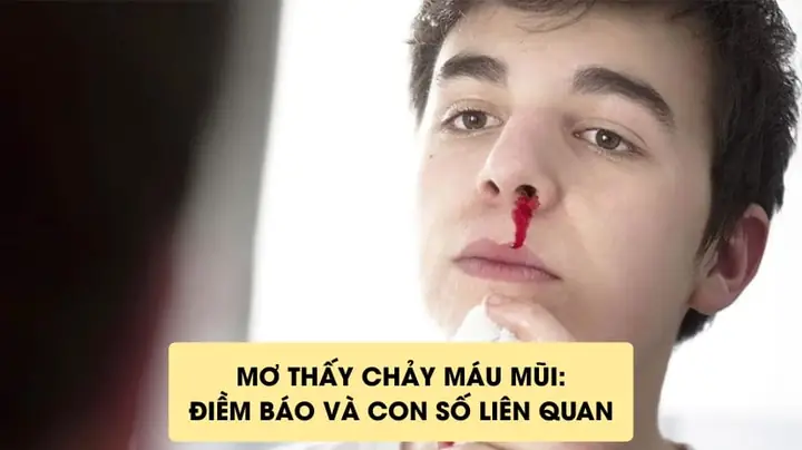 Mơ Thấy Máu Chảy: Ý Nghĩa, Điểm Báo Lành Xấu Và Cách Giải Mã
