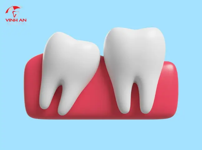 Mơ Thấy Nhổ Răng: Ý Nghĩa, Điềm Báo Và Cách Giải Thích Cho Người Mơ Mơ Thấy Nhổ Răng: Ý Nghĩa, Điềm Báo Và Cách Giải Thích Cho Người Mơ