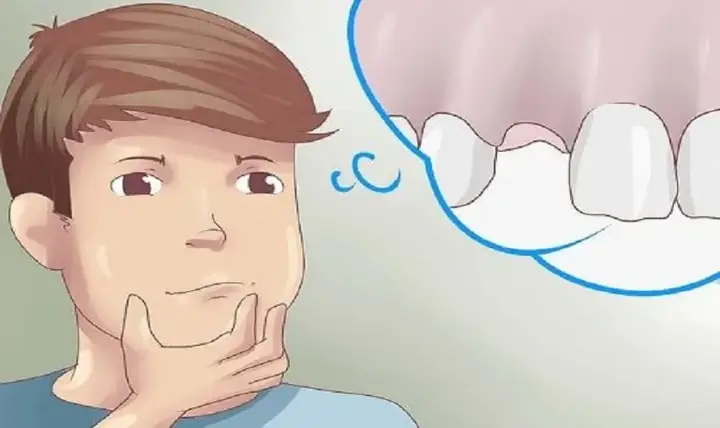 Mơ Thấy Rụng Răng Là Điềm Báo Gì
