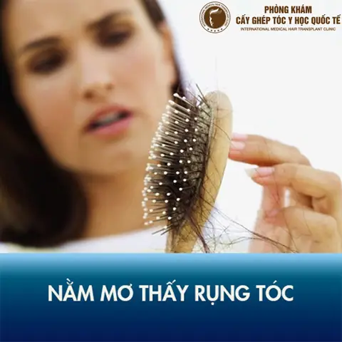 Mơ Thấy Rụng Tóc Là Điềm Gì? Giải Mã Ý Nghĩa Và Cách Đối Phó