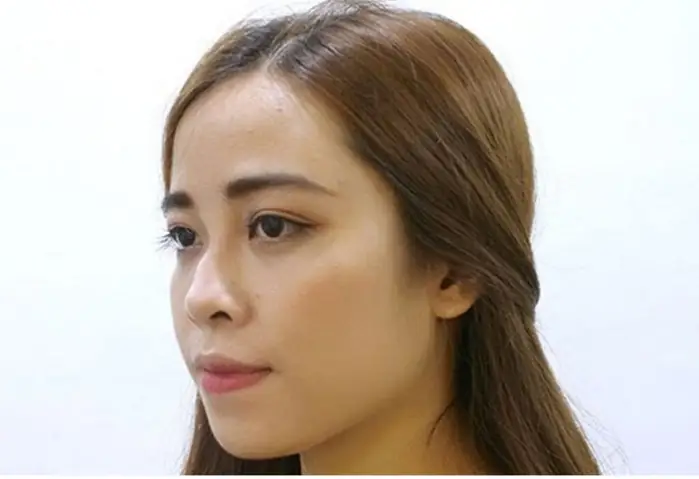 Mũi Gãy Tướng Số