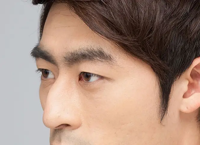 Mũi Gãy Tướng Số