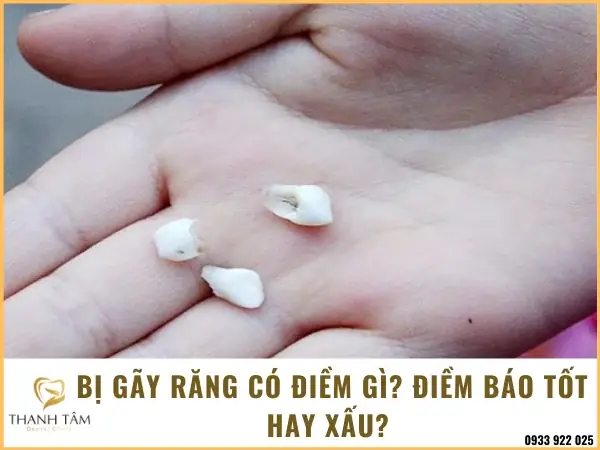 Nằm Mơ Bị Gãy Răng Là Điềm Báo Gì