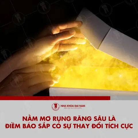 Nằm Mơ Bị Rụng Răng Là Điềm Báo Gì