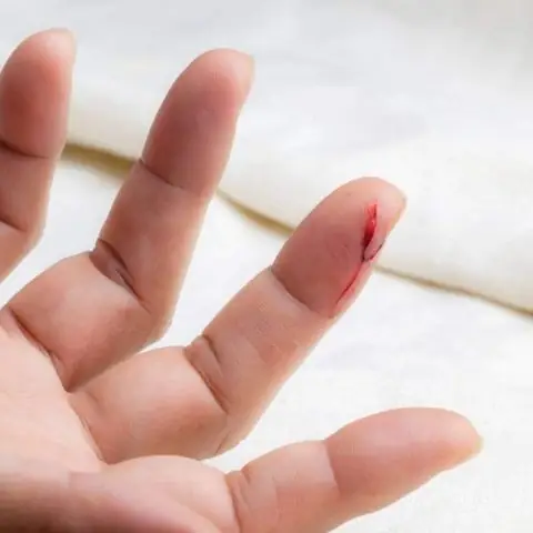 Giải Mã Giấc Mơ Cắt Móng Tay Chảy Máu: Ý Nghĩa, Dự Báo Và Cách Giải Thích Chi Tiết