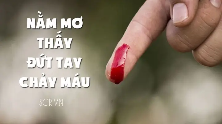 Giải Mã Giấc Mơ Cắt Móng Tay Chảy Máu: Ý Nghĩa, Dự Báo Và Cách Giải Thích Chi Tiết