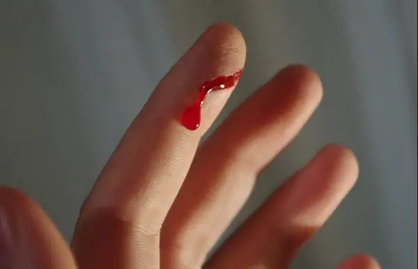 Nằm Mơ Thấy Máu Đỏ: Ý Nghĩa, Điềm Báo Và Các Con Số May Mắn Nằm Mơ Thấy Máu Đỏ: Ý Nghĩa, Điềm Báo Và Các Con Số May Mắn
