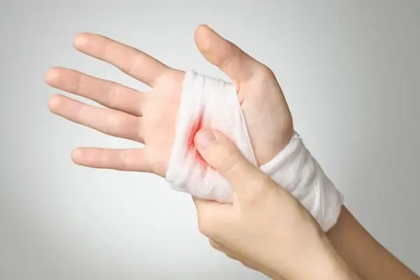 Nằm Mơ Thấy Mình Bị Chảy Máu Tay: Ý Nghĩa, Lời Giải Mã Và Cách Đối Phó Nằm Mơ Thấy Mình Bị Chảy Máu Tay: Ý Nghĩa, Lời Giải Mã Và Cách Đối Phó