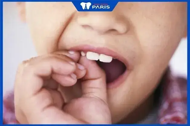 Giải Mã Giấc Mơ Thấy Răng Bị Mẻ Và Các Con Số May Mắn Giải Mã Giấc Mơ Thấy Răng Bị Mẻ Và Các Con Số May Mắn