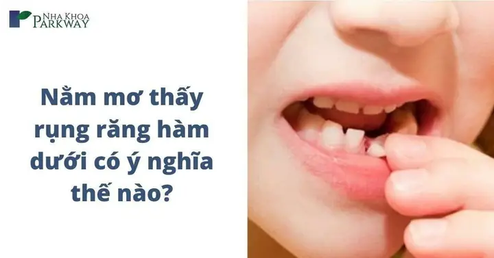 Nằm Mơ Thấy Rụng Răng Hàm Trên Chảy Máu Nằm Mơ Thấy Rụng Răng Hàm Trên Chảy Máu