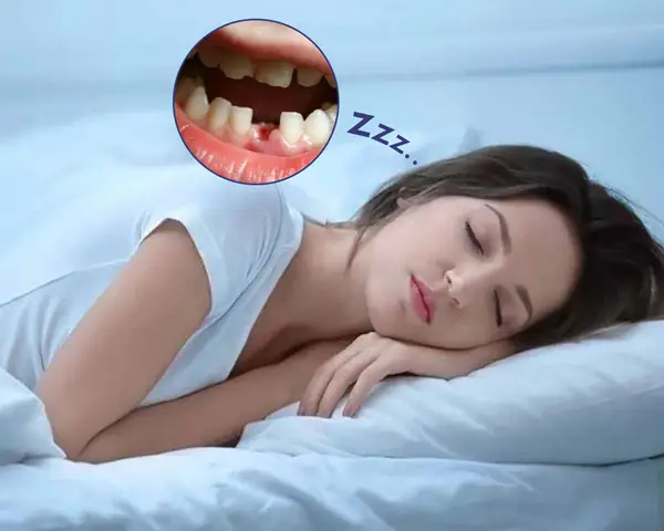 Nằm Mơ Thấy Rụng Răng Không Chảy Máu: Ý Nghĩa, Diễn Giải Và Lời Khuyên