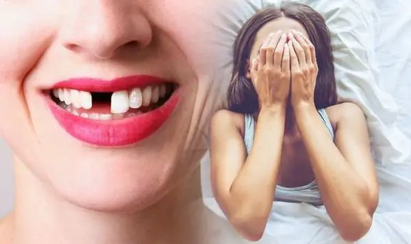 Nằm Mơ Thấy Rụng Răng Không Chảy Máu: Ý Nghĩa, Diễn Giải Và Lời Khuyên