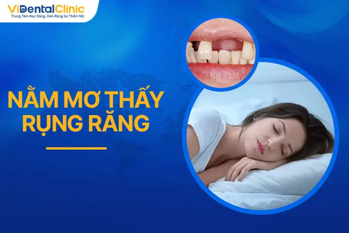 Nằm Mơ Thấy Rụng Răng Tốt Hay Xấu