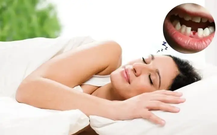 Giải Mã Giấc Ngủ Mơ Bị Rụng Răng: Điềm Báo Gì Và Cách Hiểu Đúng