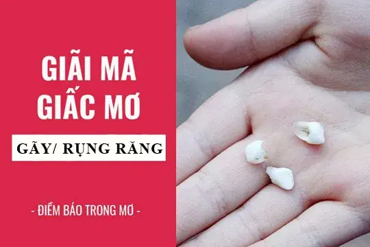 Giải Mã Giấc Ngủ Mơ Thấy Rụng Răng: Điềm Báo Gì Và Cách Hiểu Cho Người Mơ