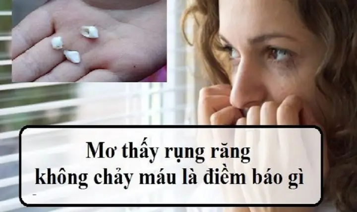 Nhức Nướu Răng Cùng Có Điềm Báo Gì K Nhức Nướu Răng Cùng Có Điềm Báo Gì K