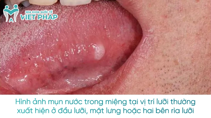 Những Hình Ảnh “chảy Nước Miếng” Khiến Bạn Thèm Muốn: Bộ Sưu Tập Meme, Ảnh Thực Tế Và Cách Tải Miễn Phí Những Hình Ảnh “chảy Nước Miếng” Khiến Bạn Thèm Muốn: Bộ Sưu Tập Meme, Ảnh Thực Tế Và Cách Tải Miễn Phí