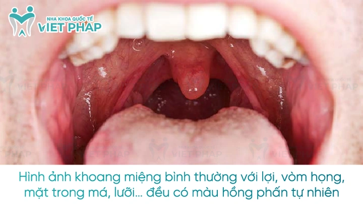 Những Hình Ảnh “chảy Nước Miếng” Khiến Bạn Thèm Muốn: Bộ Sưu Tập Meme, Ảnh Thực Tế Và Cách Tải Miễn Phí Những Hình Ảnh “chảy Nước Miếng” Khiến Bạn Thèm Muốn: Bộ Sưu Tập Meme, Ảnh Thực Tế Và Cách Tải Miễn Phí