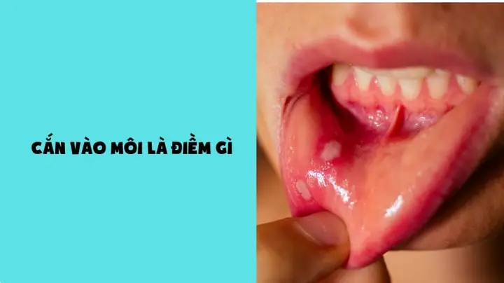 Quả Rơi Vào Người Là Điềm Gì Quả Rơi Vào Người Là Điềm Gì