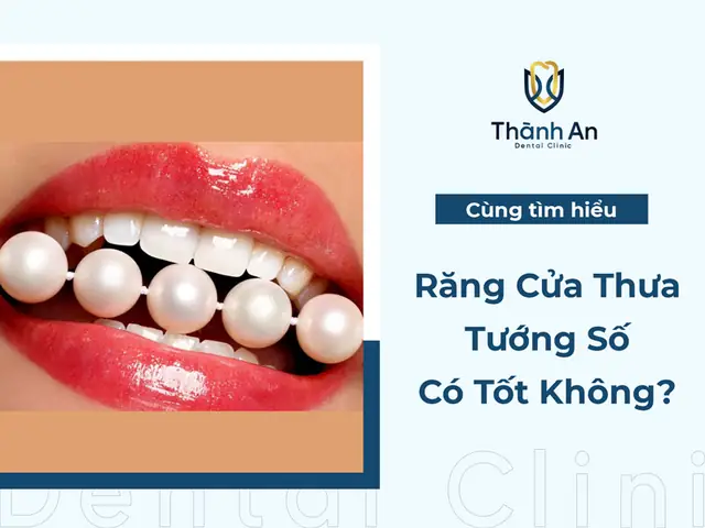 Răng Cửa Thưa Tướng Số Răng Cửa Thưa Tướng Số