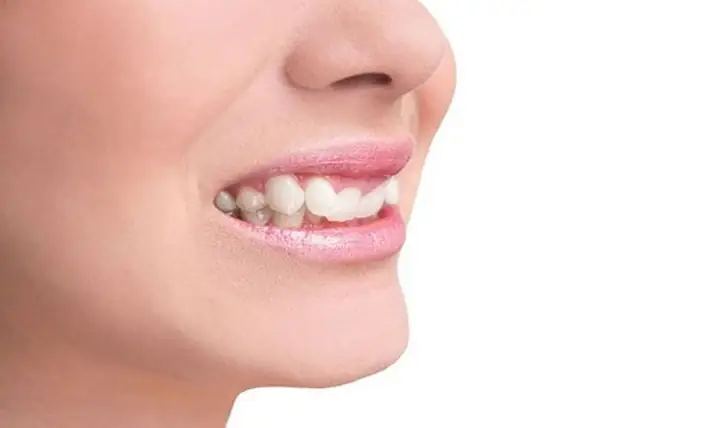 Răng Quặp Vào Trong Tướng Số Răng Quặp Vào Trong Tướng Số