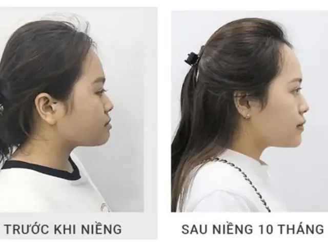 Thay Đổi Tướng Số Trên Khuôn Mặt Thay Đổi Tướng Số Trên Khuôn Mặt