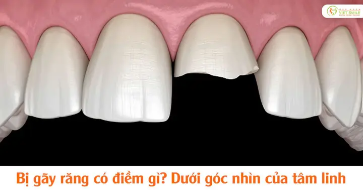 Tự Nhiên Bị Gãy Răng Có Điềm Gì Tự Nhiên Bị Gãy Răng Có Điềm Gì