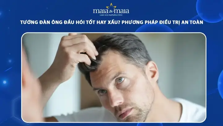 Tướng Đàn Ông Đầu To Tướng Đàn Ông Đầu To