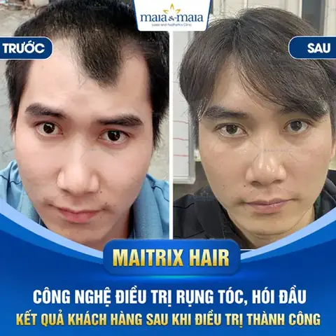 Tướng Đàn Ông Đầu To Tướng Đàn Ông Đầu To