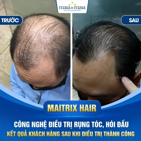 Tướng Đàn Ông Đầu To Tướng Đàn Ông Đầu To