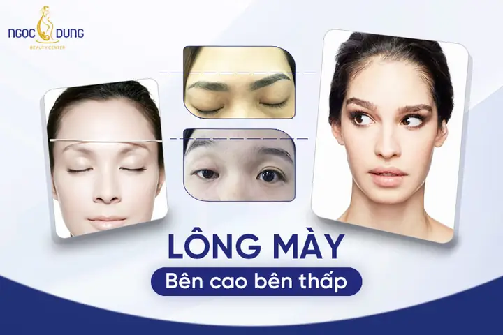 Tướng Lông Mày Bên Cao Bên Thấp Tướng Lông Mày Bên Cao Bên Thấp