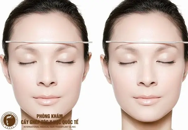Tướng Lông Mày Không Cân Xứng Tướng Lông Mày Không Cân Xứng